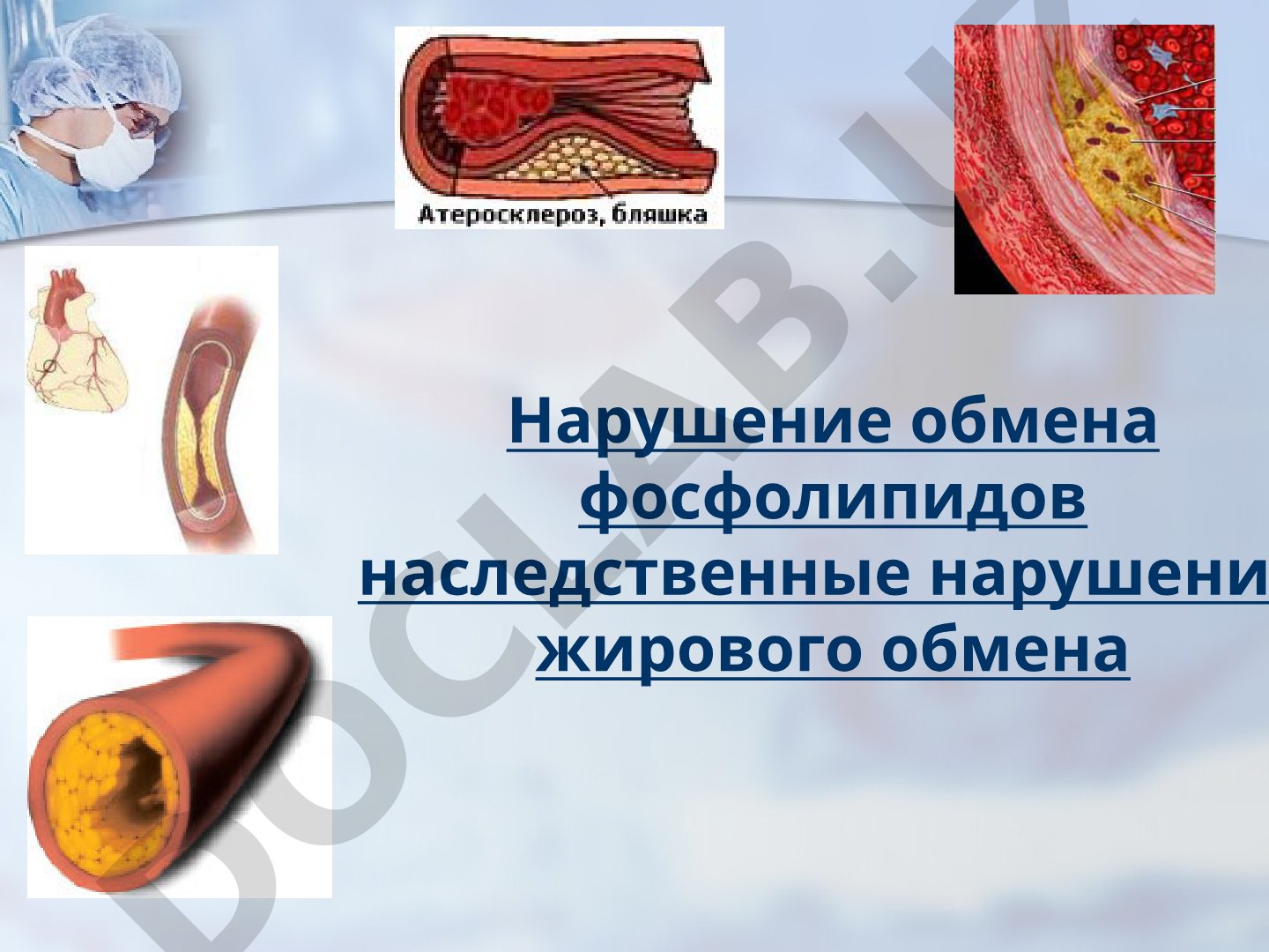 Нарушение обмена фосфолипидов наследственные нарушение жирового обмена
