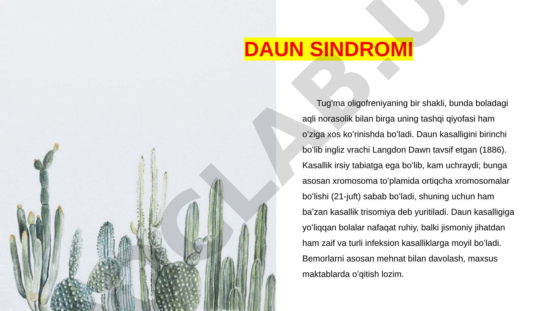 Daun sindromi, uning sabablari, belgilari va tarixi haqida ma'lumot