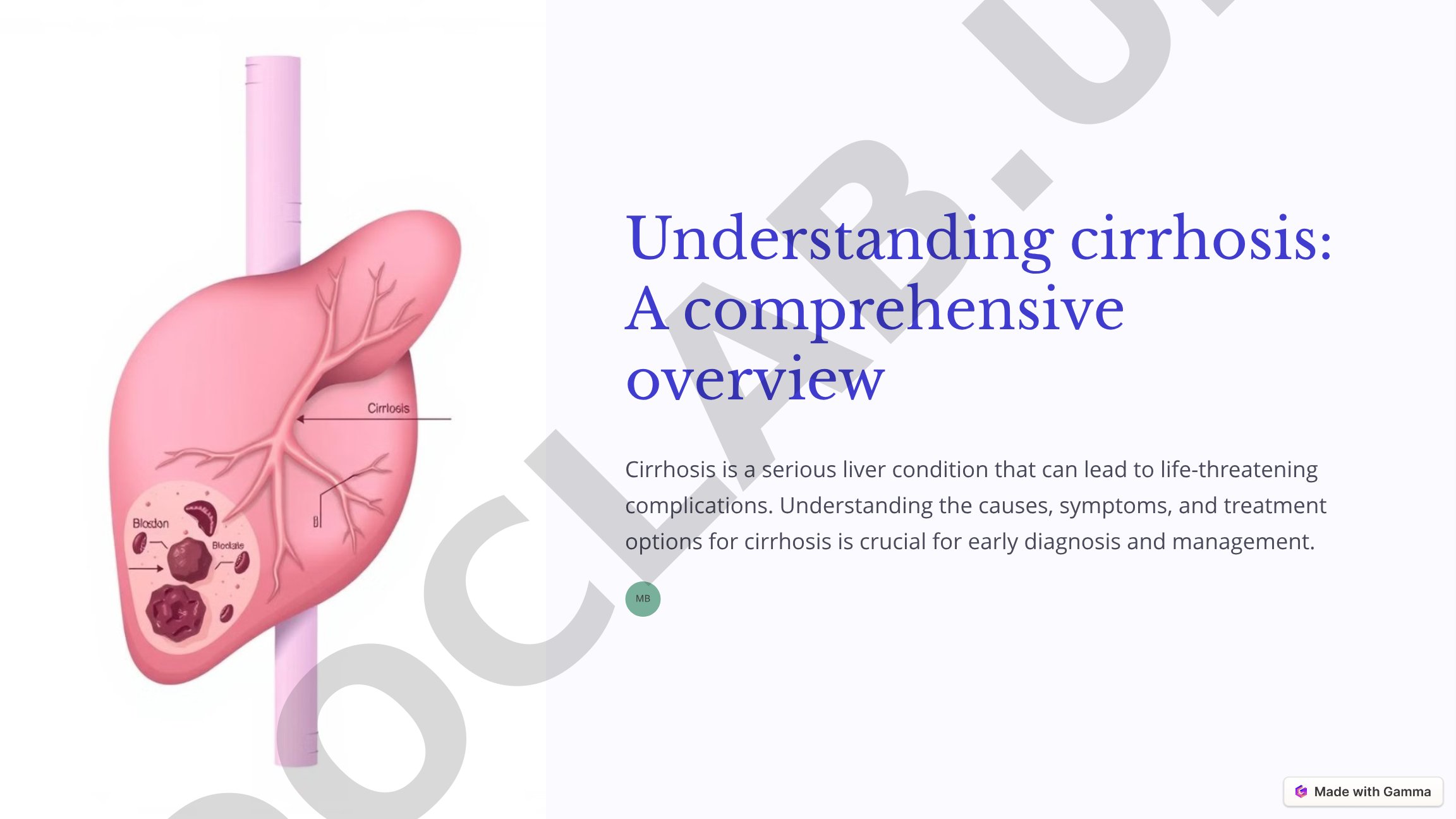 Understanding cirrhosis: A comprehensive overview