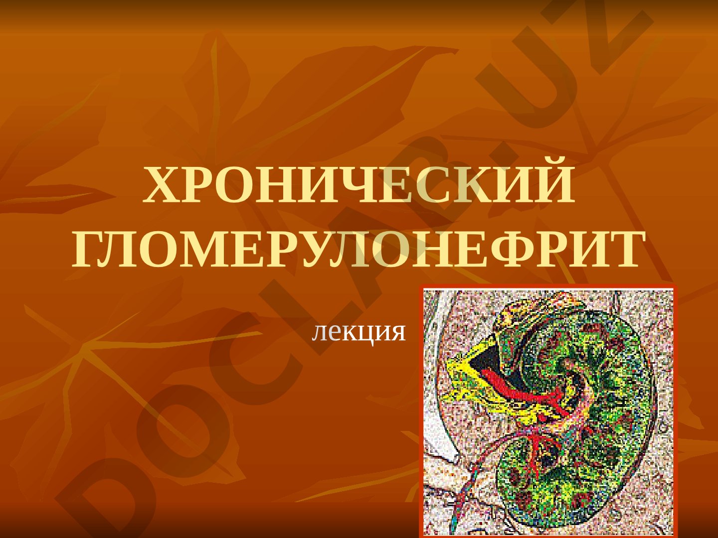 Хронический гломерулонефрит