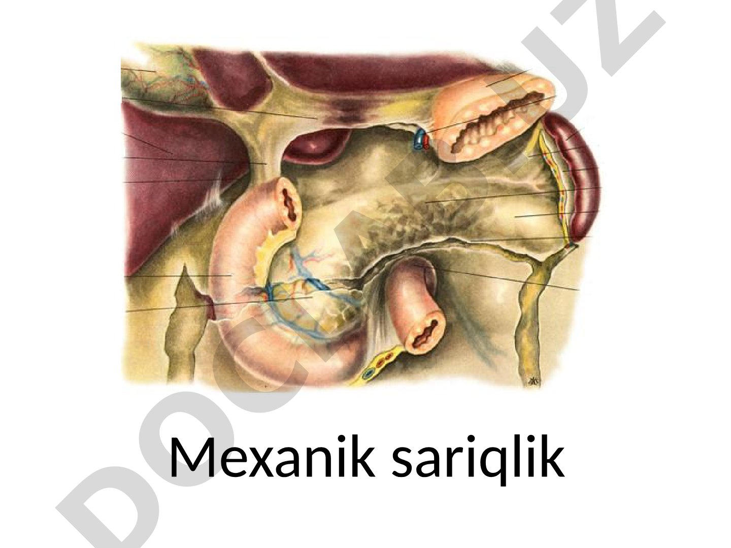 Mexanik sariqlik etiologiyasi va o't yo'llar kasalliklari