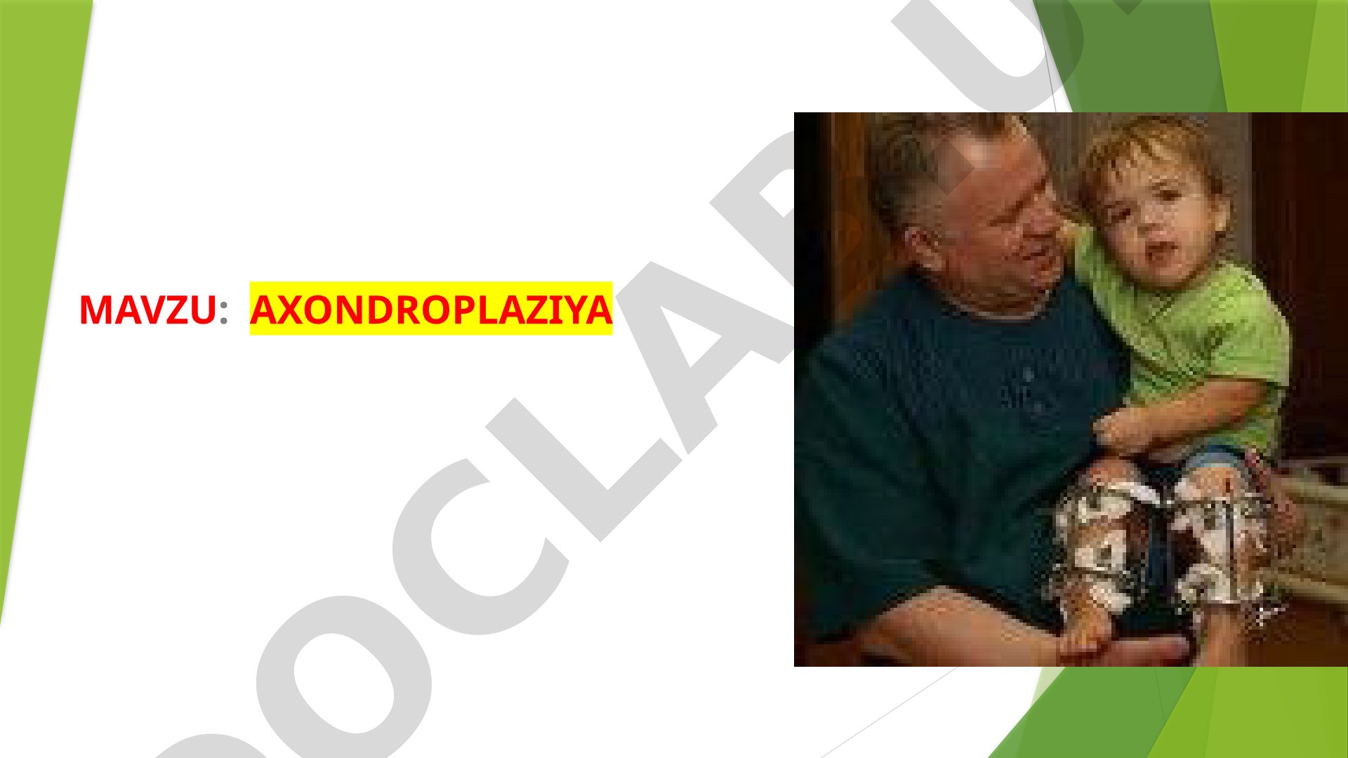 Axondroplaziya — qisqa oyoqli mittilikning bir shakli, uning xususiyatlari va belgilari