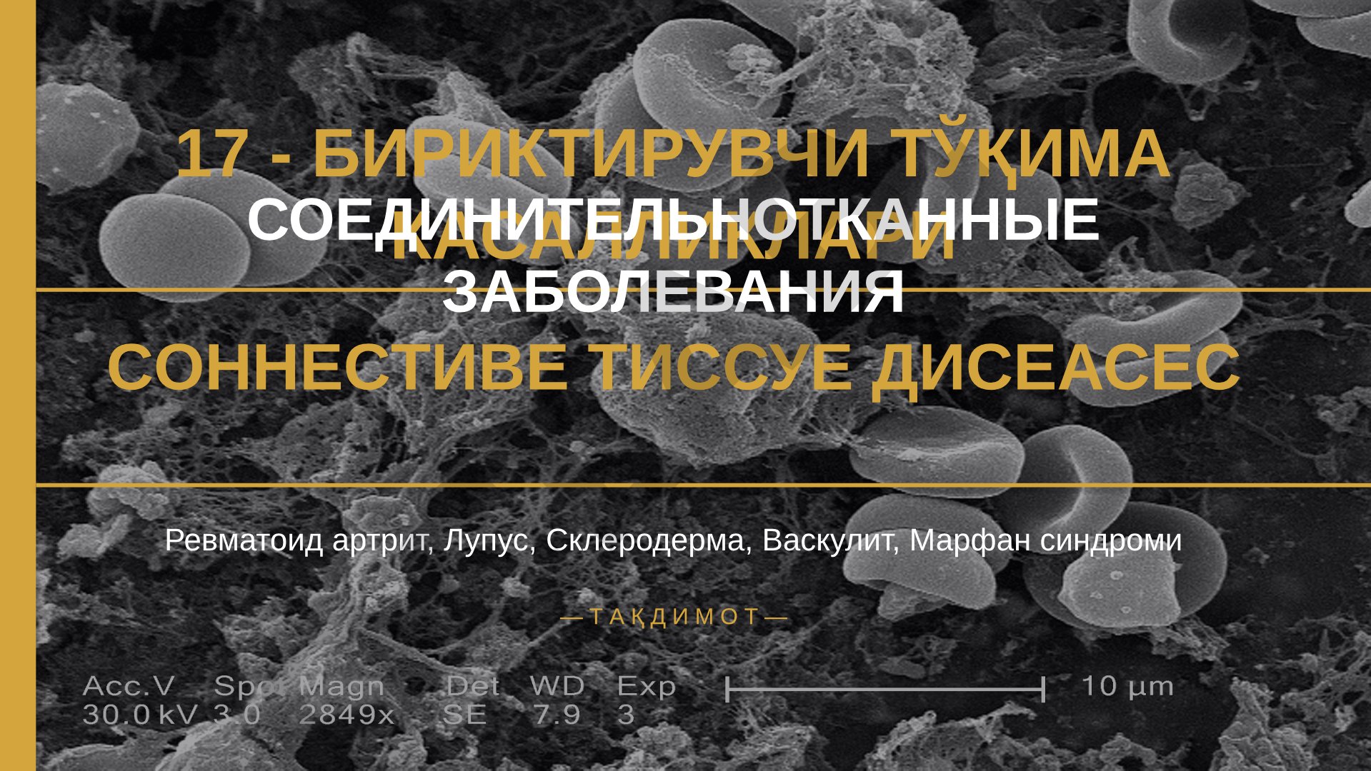 Бириктирувчи тўқима касалликлари