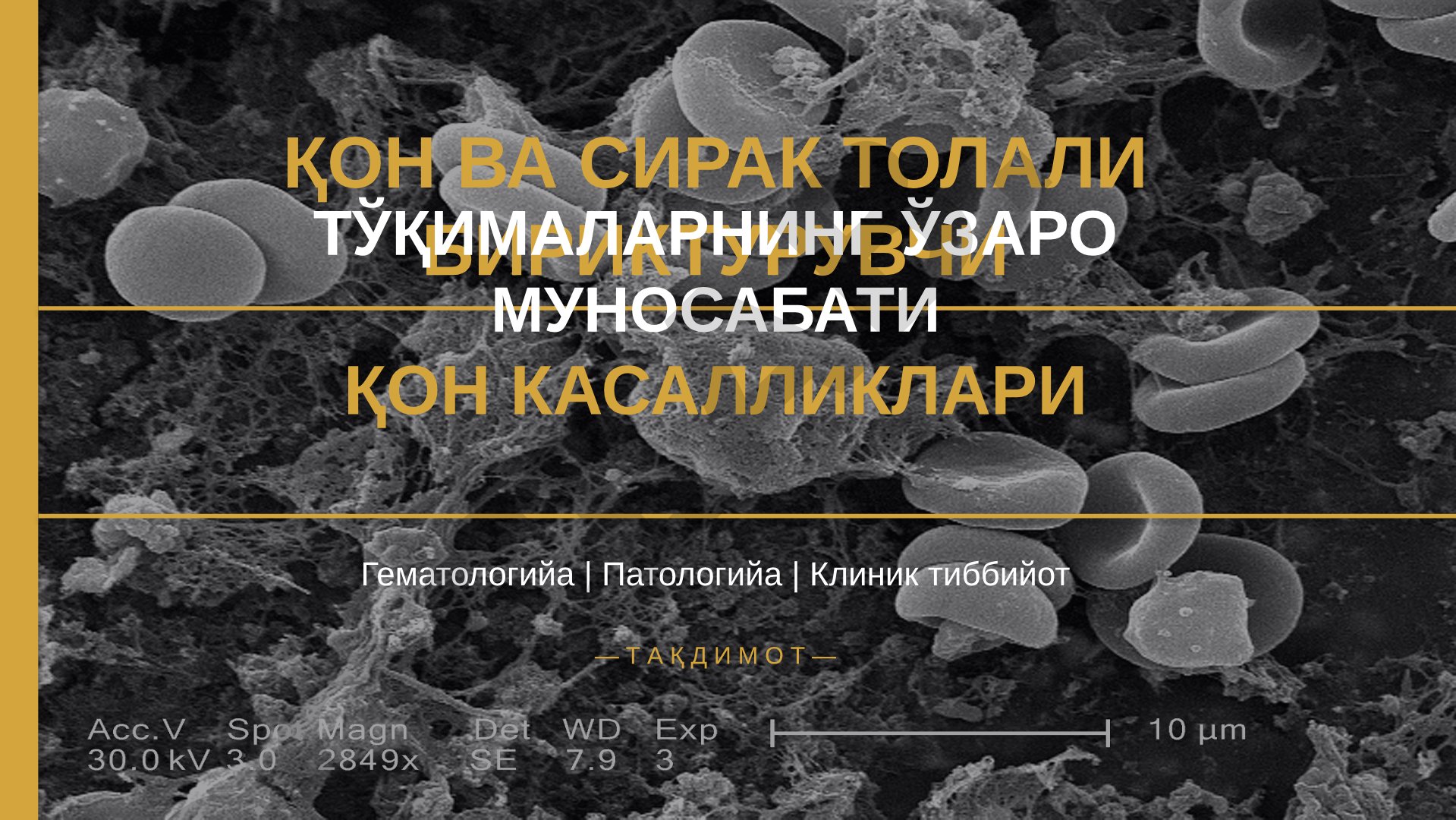 Қон ва сирак толади бирикувчи тўқималарнинг ўзаро муносабати қон касалликлари