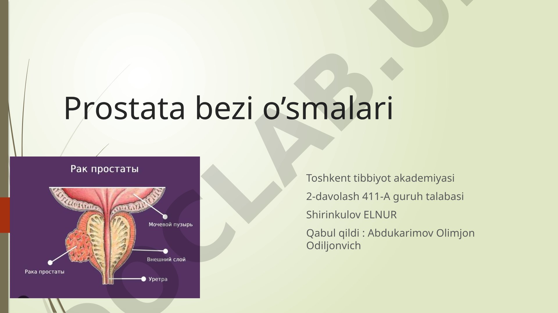 Prostata bezi o'smalari