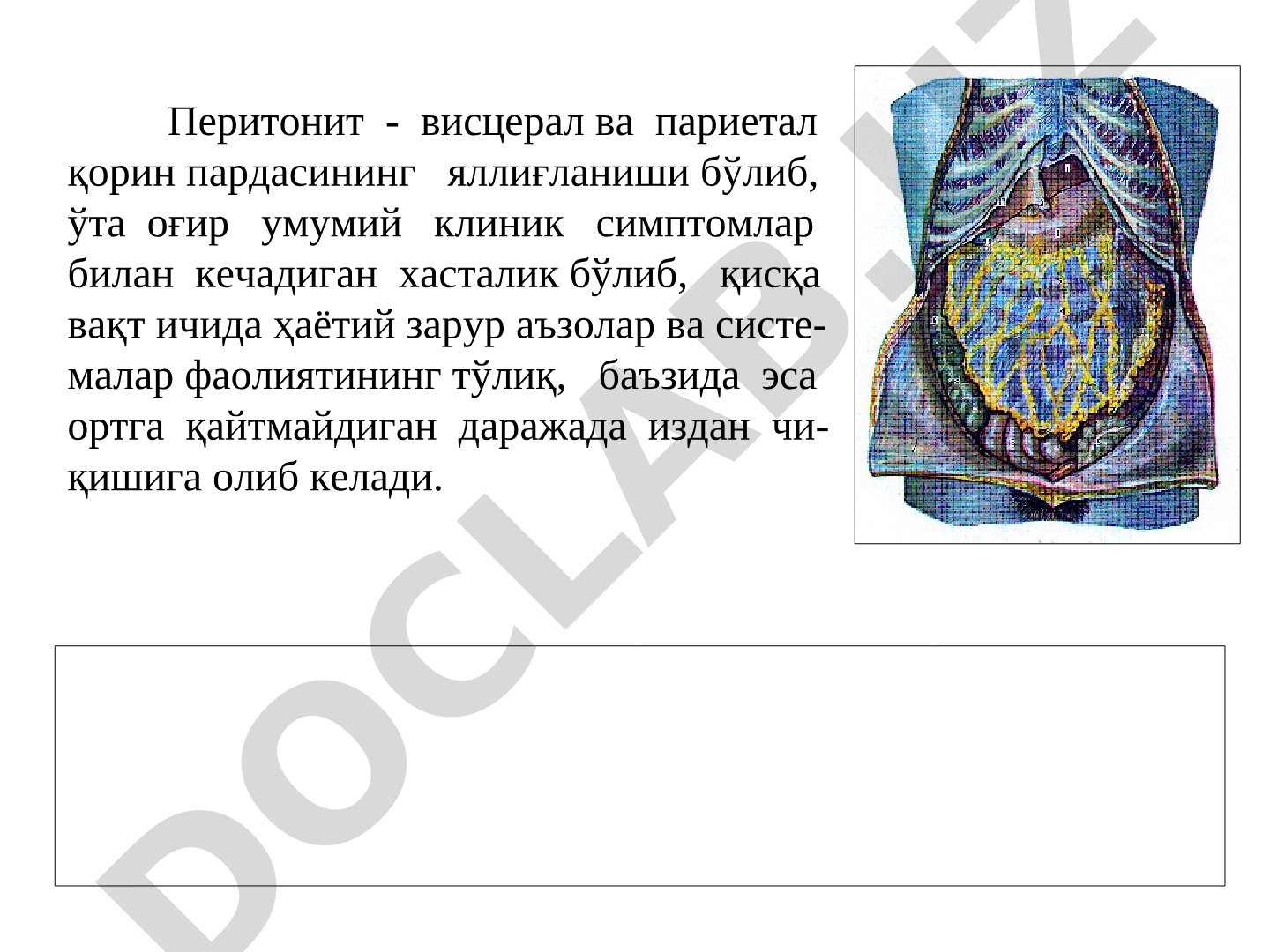 Перитонит: этиология, классификация ва клиник белгилари