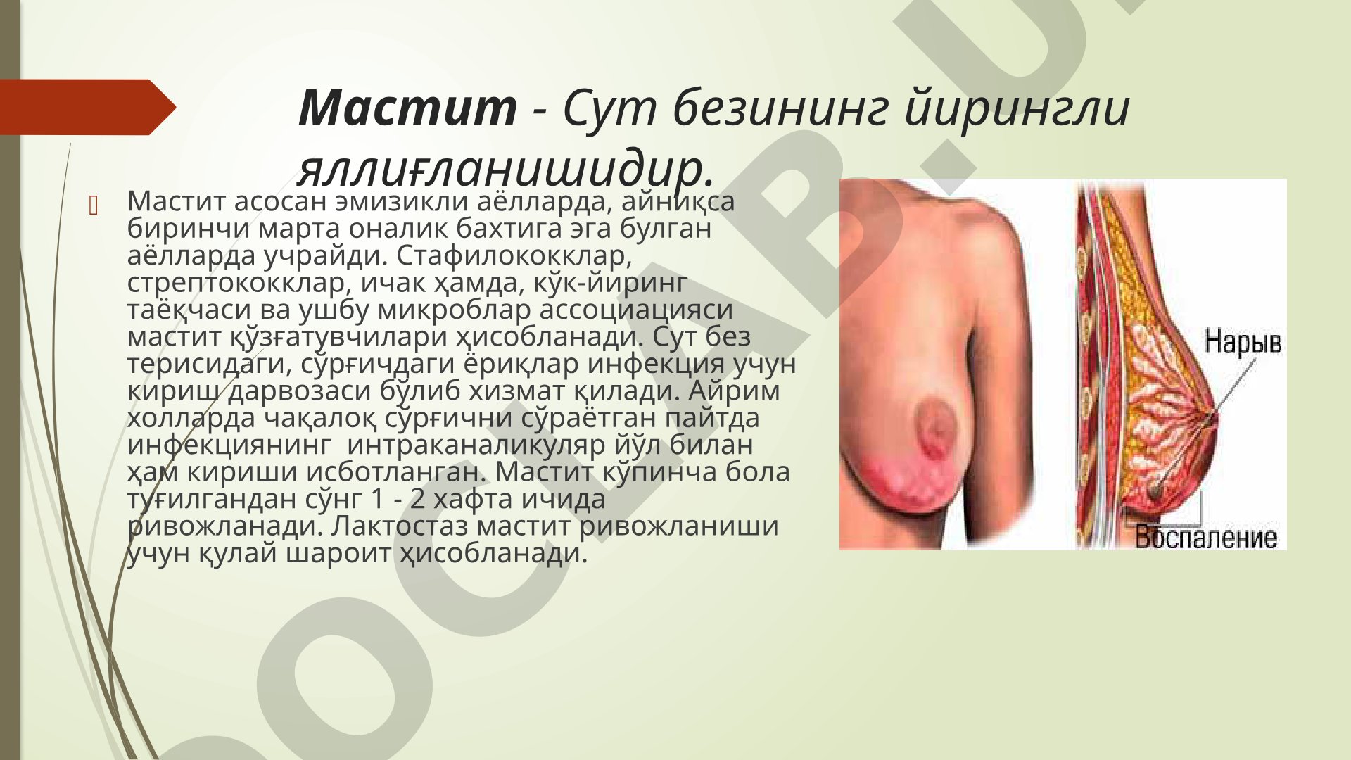 Мастит: сут безининг йирингли яллиғланиши