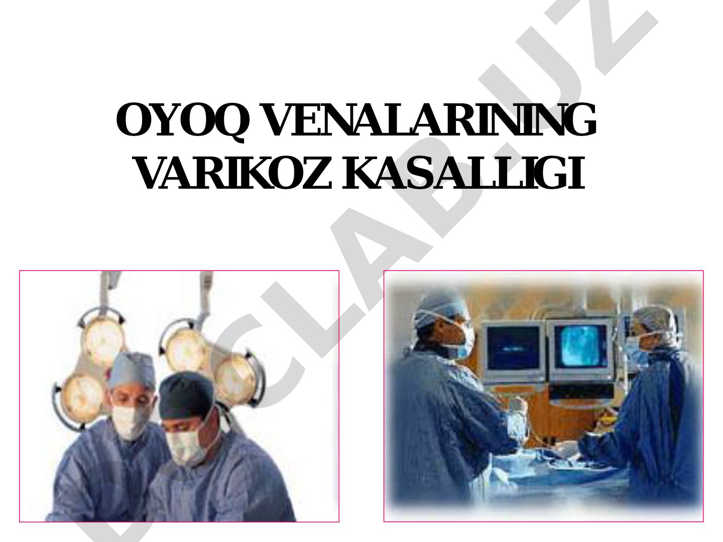 Oyoq venalarining varikoz kasalligi