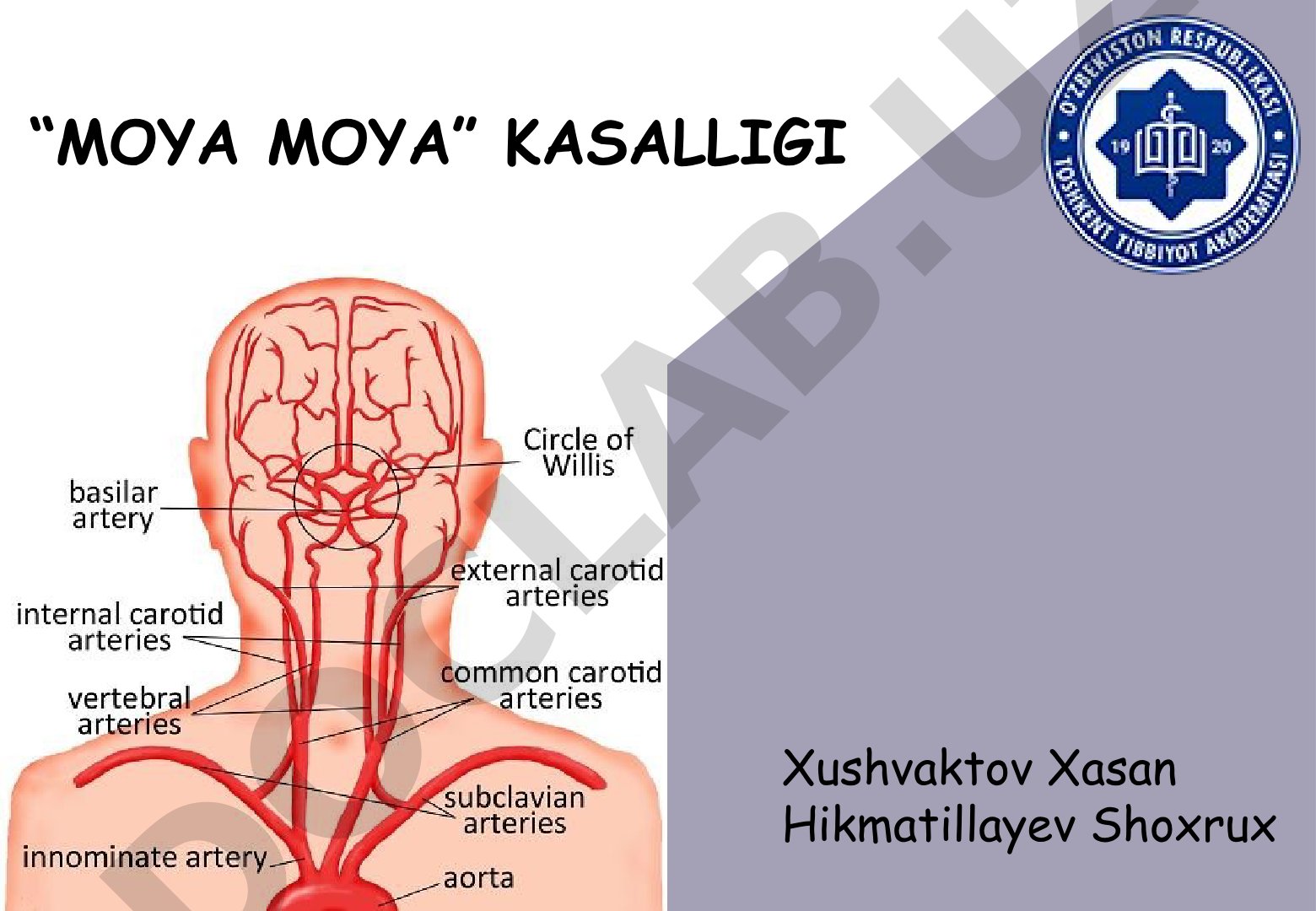 Moya moya kasalligi bosqichlari va diagnostikasi