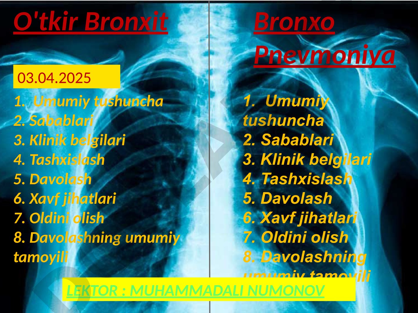 O'tkir Bronxit Bronxo Pnevmoniya