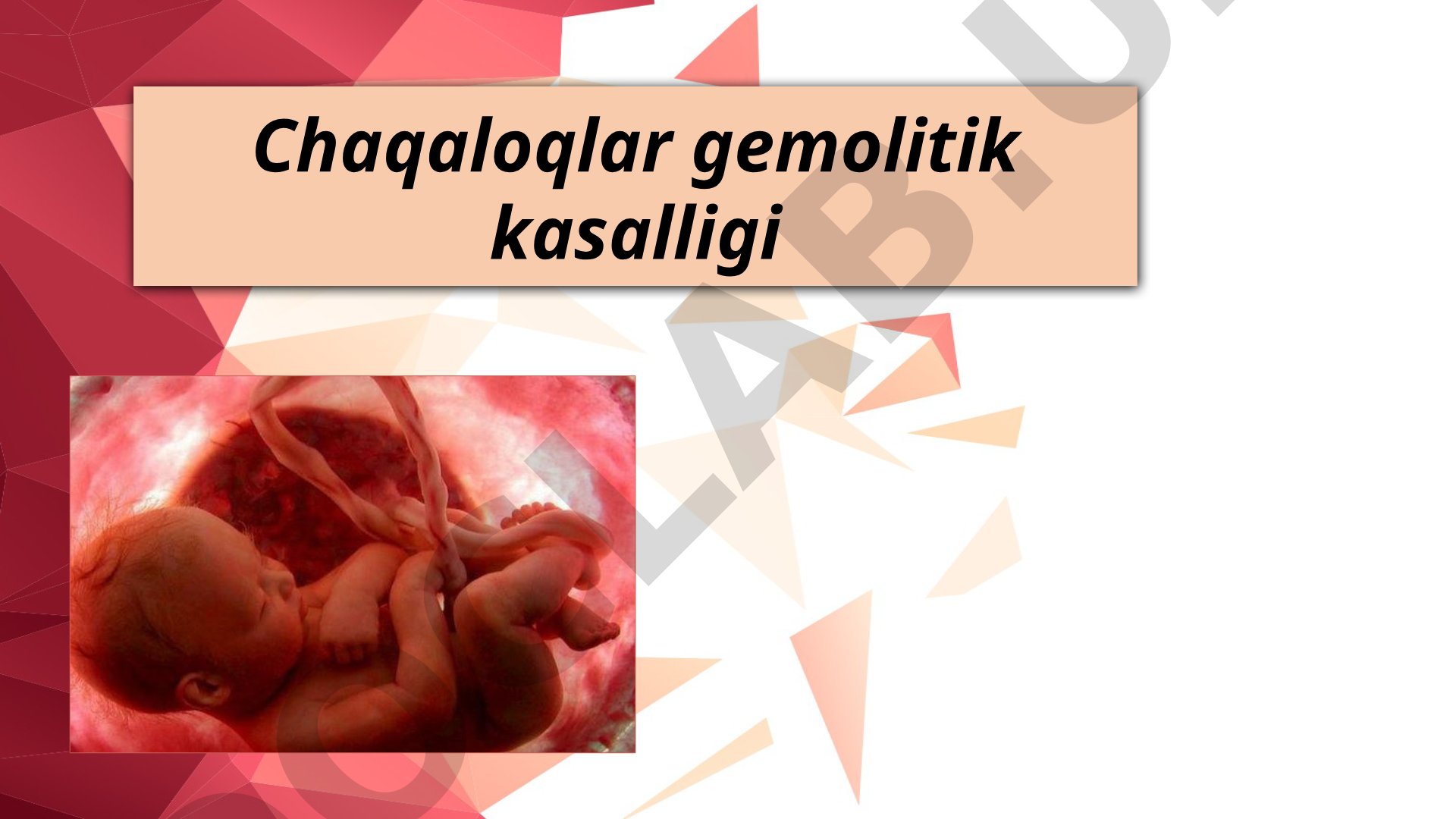 Ona va homila rezus-faktor mos kelmasligi sababli yuzaga keladigan chaqaloqlar gemolitik