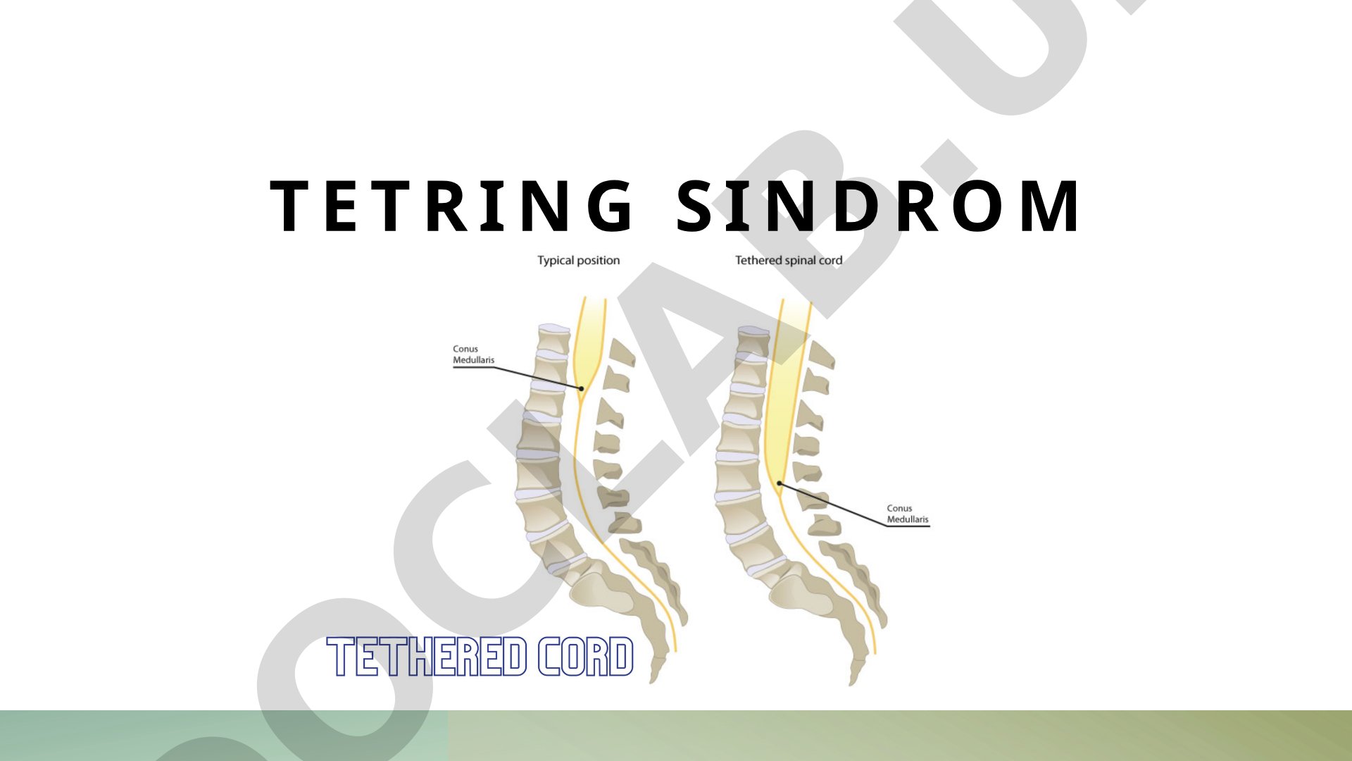 Tetring sindromi sabablari, diagnostikasi, davolash va profilaktikasi haqida ma'lumot