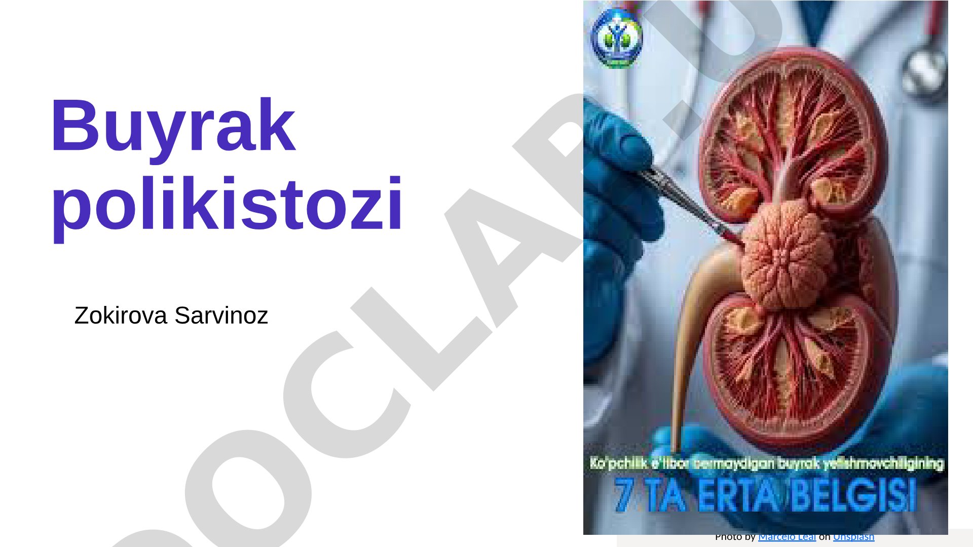 Buyrak polikistozi sabablari, patofiziologiyasi, klinik kechishi, diagnostikasi va